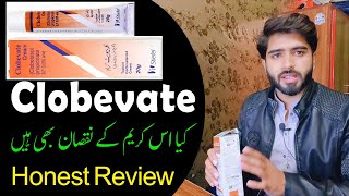 Clobevate Cream For Whitening  Clobevate Uses In Urdu  Clobevate  Babar Ali [upl. by Horter]