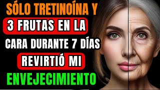 SECRETO DE LAS CELEBRITIES LA TRETINOÍNA PARA 7 DÍAS EN EL ROSTRO ES RICA EN COLÁGENO Y ANTIEDAD [upl. by Enelloc311]