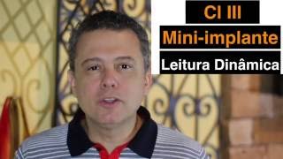 Tratamento da classe III com cursor inferior e miniimplantes  Leitura dinâmica [upl. by Darbee]