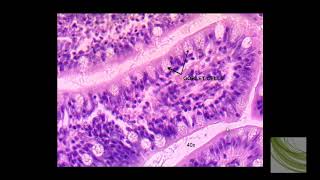 SLIDE Simple Columnar Epithelium [upl. by Eremaj933]