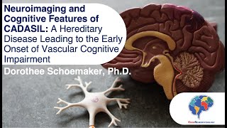 Neuroimaging and Cognitive Features of CADASIL [upl. by Neelcaj406]