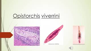 Clonorchis sinensis y opistorchis viverrini [upl. by Wolcott]