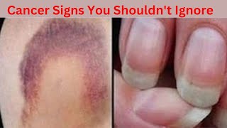 Early Cancer Warning Signs Symptoms You Shouldnt Ignore [upl. by Laucsap609]