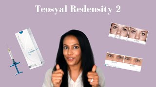 Teosyal Redensity 2 Under Eye Filler  Tear Trough Filler Explained [upl. by Kobe70]