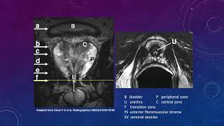 Introduction to PIRADS [upl. by Ama491]