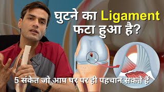 घुटने का Ligament फटा हुआ है 5 संकेत जो आप घर पर ही पहचान सकते हैं [upl. by Enneite710]