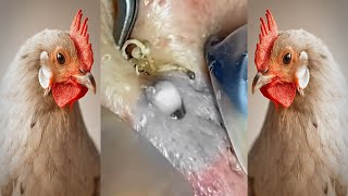 acne removal blackheads nose 03 [upl. by Soloma976]