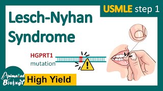 LeschNyhan syndrome  What are the symptoms of LeschNyhan syndrome  Treatment options  USMLE [upl. by Aneri116]