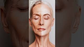 Fillers Vs Facelift how to decide drprateeksharma eveite fillers facelift cosmeticsurgery [upl. by Dotty]