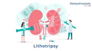 Understanding Lithotripsy A Guide to PreProcedure and PostProcedure  Manipal Hospitals India [upl. by Innep]