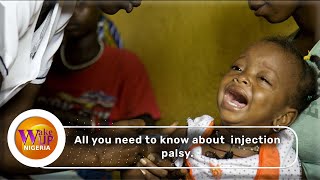 What are the symptoms of injection palsy Watch [upl. by Qulllon]