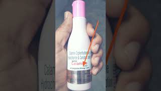 calamine lotion uses  complete allergy treatment [upl. by Downs]