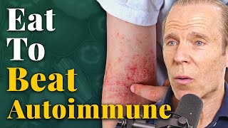 How a Nutritarian Diet Can REVERSE Autoimmune Diseases  Dr Joel Fuhrman [upl. by Gerc58]