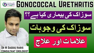 Gonorrhea Gonorrhea Treatment  Gonorrhea Meaning  SOZAK  سوزاک کیا ہے؟  سوزاک کا علاج [upl. by Neroled941]