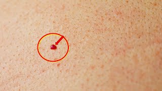 Do you have red spots on your skin Heres what they mean [upl. by Rikki971]