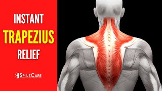 How to Fix Upper Trapezius Pain FOR GOOD [upl. by Ringsmuth]