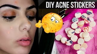 bandaids for acne  THE BEST OVERNIGHT PIMPLE SPOT TREATMENT HANDS DOWN  DIY [upl. by Eicart]