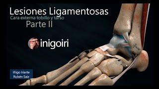 US EN LESIONES LIGAMENTOS EXTERNOS DEL TOBILLO PARTE II [upl. by Baum]