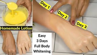 I applied👆this Skin Whitening Lotion On Dark HandsIn 3 Days Dark Dull Skin Got Fair White amp Glowing [upl. by Nelrah]