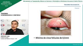 IMT2005 08 Tracoma epidemiologia e controle [upl. by Chucho]