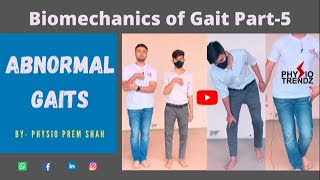 Antalgic gait Hemiplegic gait All Abnormal Gait Demonstration Gait biomechanics [upl. by Ahsimak]