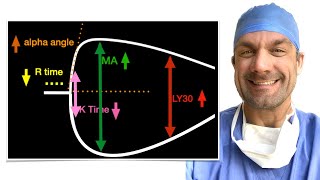 Understand TEG  Thromboelastogram Make it easy [upl. by Bella]