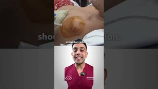 How Can You Fix A Dislocated Shoulder [upl. by Nuahsyd]