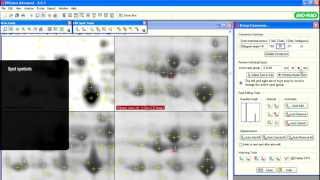 PDQuest™ Software Tutorials — Editing Protein Spot Analysis [upl. by Anina]