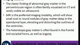 Subependymal graymatter heterotopia periventricular nodular heterotopia febrile seizures [upl. by Areis306]