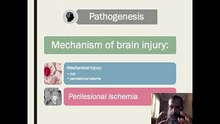 intracerebral hemorrhage [upl. by Slayton586]