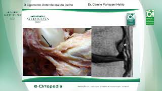 O Ligamento Anterolateral do joelho  Dr Camilo Partezani Helito [upl. by Ettenajna]