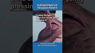 Are Infraspinatus Trigger Points Causing You Pain [upl. by Ailesor24]