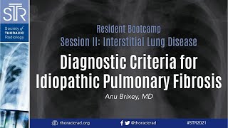 Diagnostic Criteria for Idiopathic Pulmonary Fibrosis [upl. by Nudd506]