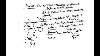 Fracture Neck Femur GKSINGH ERALMCH [upl. by Deehan]