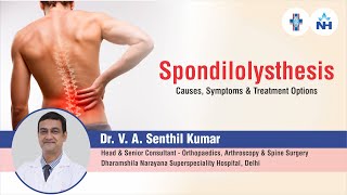 Spondylolisthesis  Causes Symptoms and Treatment Options  Dr V A Senthil Kumar [upl. by Peatroy570]