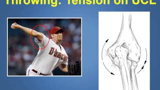 Ulnar Collateral Ligament Injuries amp Treatment Explained by a Phoenix Orthopedic 4802193342 [upl. by Tenaej]