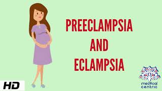 Preeclampsia and Eclampsia Causes Signs and Symptoms Diagnosis and Treatment [upl. by Halfon906]