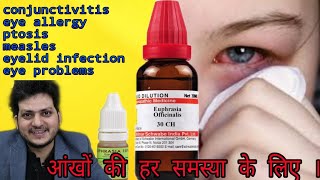 Euphrasia officinalis Homeopathic medicine for eye problems  sign amp Symptoms dosage [upl. by Maria]