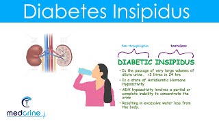 Diabetes Insipidus DI Causes Symptoms Diagnosis and treatment [upl. by Odraleba]