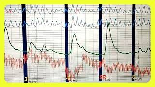 GRÁFICA DEL POLIGRAFO [upl. by Harrell]
