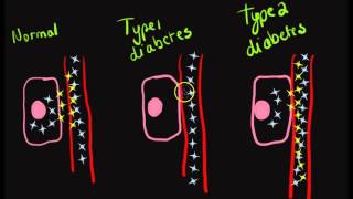 Glucose metabolism in type 1 and type 2 diabetes [upl. by Herrah]