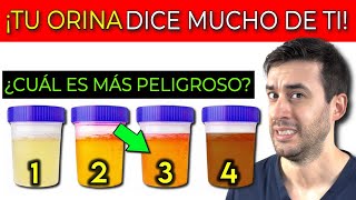 ¡Lo que tu ORINA DICE DE TU SALUD 4 SÍNTOMAS INICIALES de INSUFICIENCIA RENAL [upl. by Frymire]