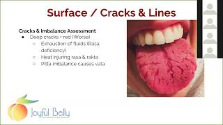 Art of Ayurveda Tongue Diagnosis 5 of 9 Tongue Surface Cracks Spots amp Bumps [upl. by Sprage]