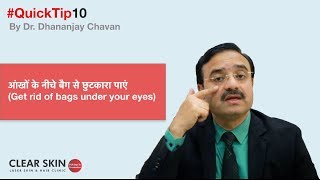 आंखों के नीचे बैग से छुटकारा पाएं Get rid of bags under your eyes  ClearSkinTips 10  In HINDI [upl. by Dee]