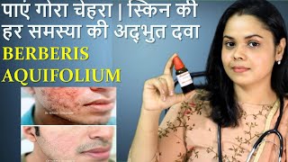 Berberis Aquifolium Homeopathic medicine for fairness acne pimples problems [upl. by Armillda]