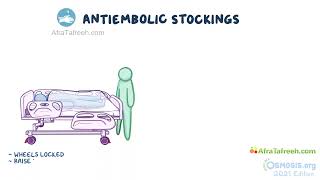 Application of Anti embolic device and sequential compression  Nursing  Osmosis [upl. by Gatias]