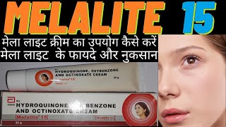 melalite cream use in hindi मेला लाइट क्रीम का उपयोग कैसे करें how to use melalite 15 side amp effects [upl. by Ithnan613]