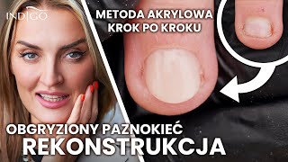 Rekonstrukcja paznokcia akrylem Jak naprawić obgryzione paznokcie krok po kroku  Indigo Nails [upl. by Eirrak]