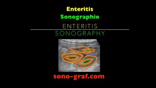 Sonographie  Enteritis [upl. by Nonohcle]