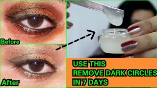 Under Eye Gel to Remove Dark Circles in 7 days  How to remove dark circles [upl. by Hewitt]